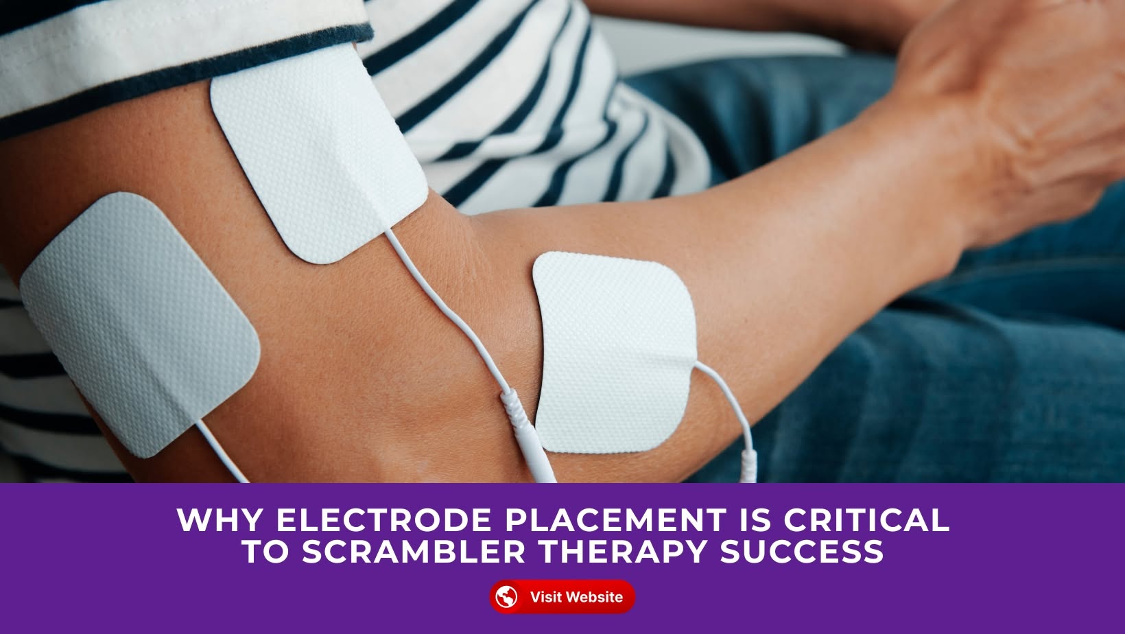 Why Electrode Placement Is Critical graphic for South Florida Scrambler Therapy